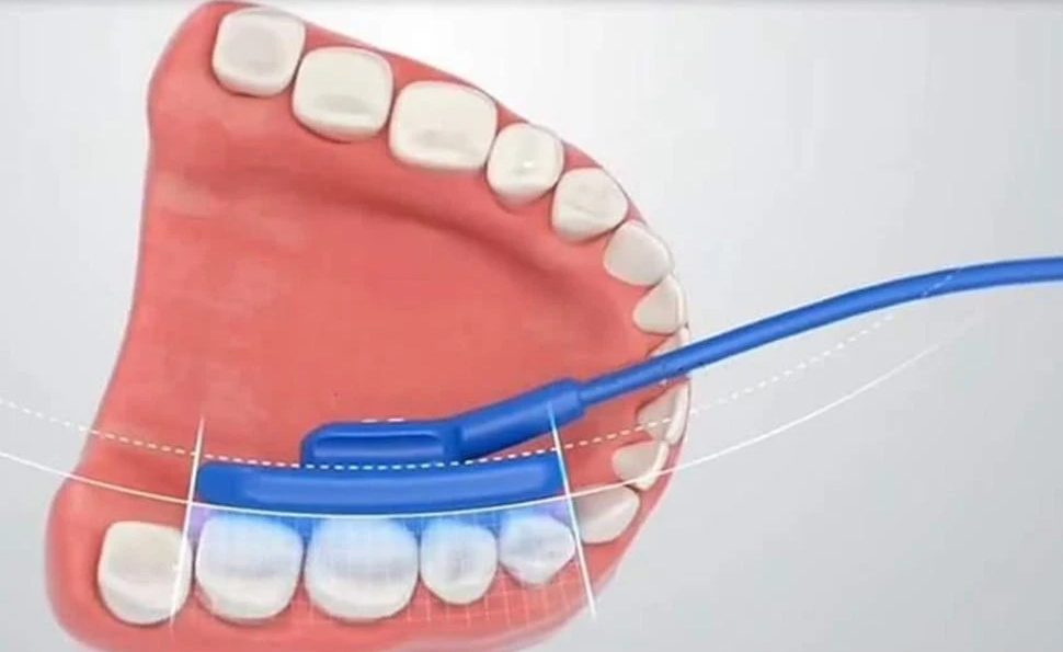 intraoral